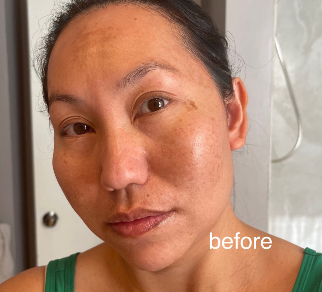 Close-up of a woman's face labeled 'before' showing natural skin.