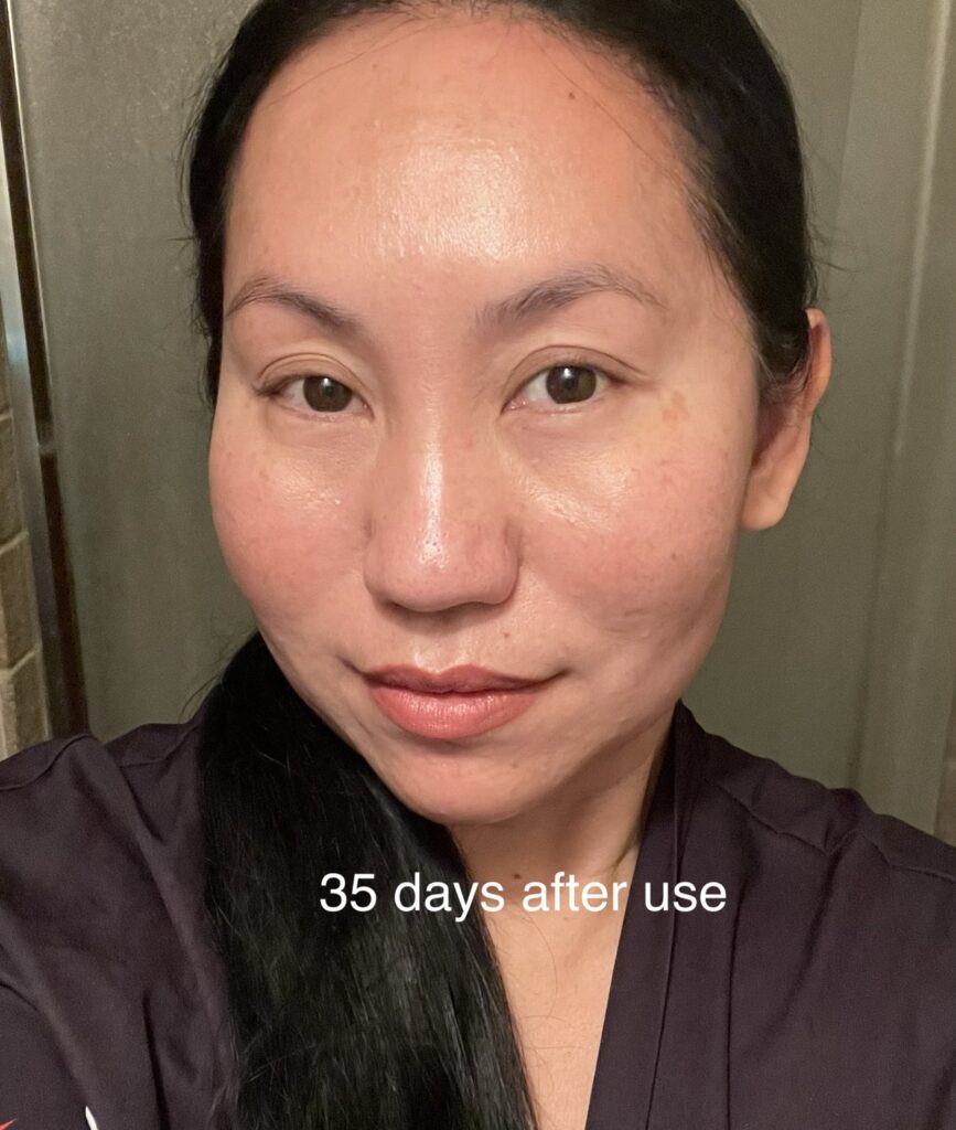 A woman showing her clear skin 35 days after using a product.